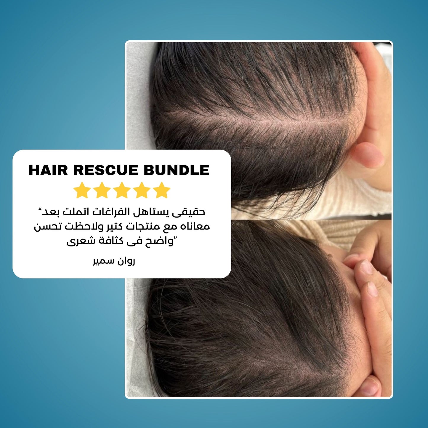 Hair Rescue Bundle